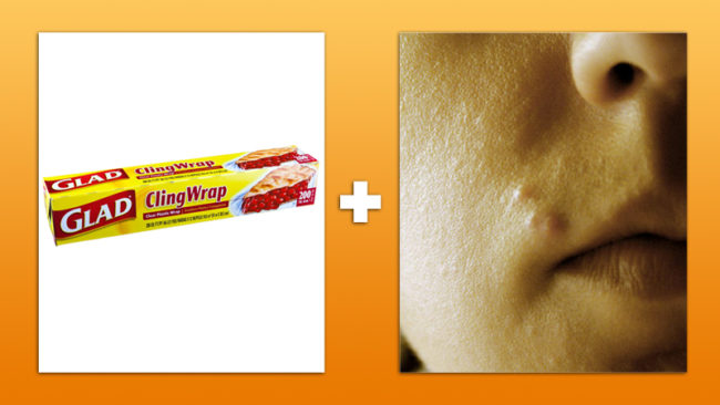 You can rid yourself of blackheads with some plastic wrap and Vaseline. Find out how <a href="http://dropdeadgorgeousdaily.com/2014/08/how-to-get-rid-of-blackheads/" target="_blank">here.</a>