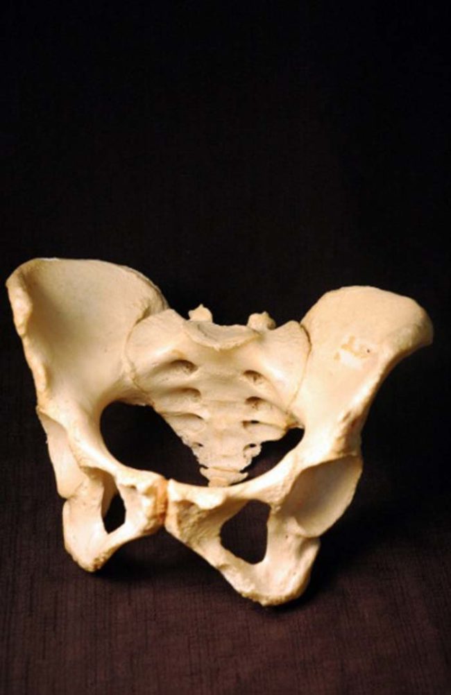 Need a new pelvis? You can grab this one for just $550.