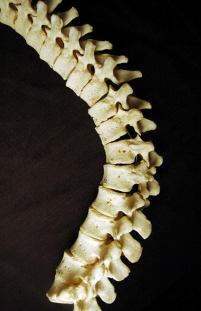 This complete set of human vertebrae could run you up to $1,400.