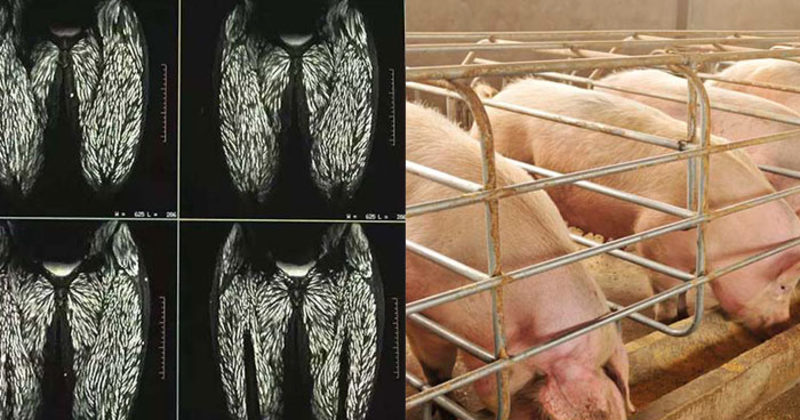 This X Ray Of A Woman Who Ate Raw Pork Will Convince You To Become A this-x-ray-of-a-woman-who-ate-raw-pork-will-convince-you-to-become-a